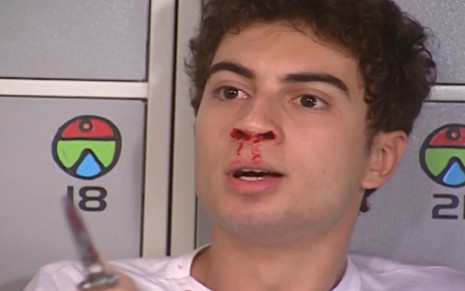 Pedro Furtado caracterizado como Fred; ele tem os cabelos escuros, usa uma camiseta branca e esta atormentado. O nariz do ator sangra, e ele aponta um canivete para frente em cena de Mulheres Apaixonadas.