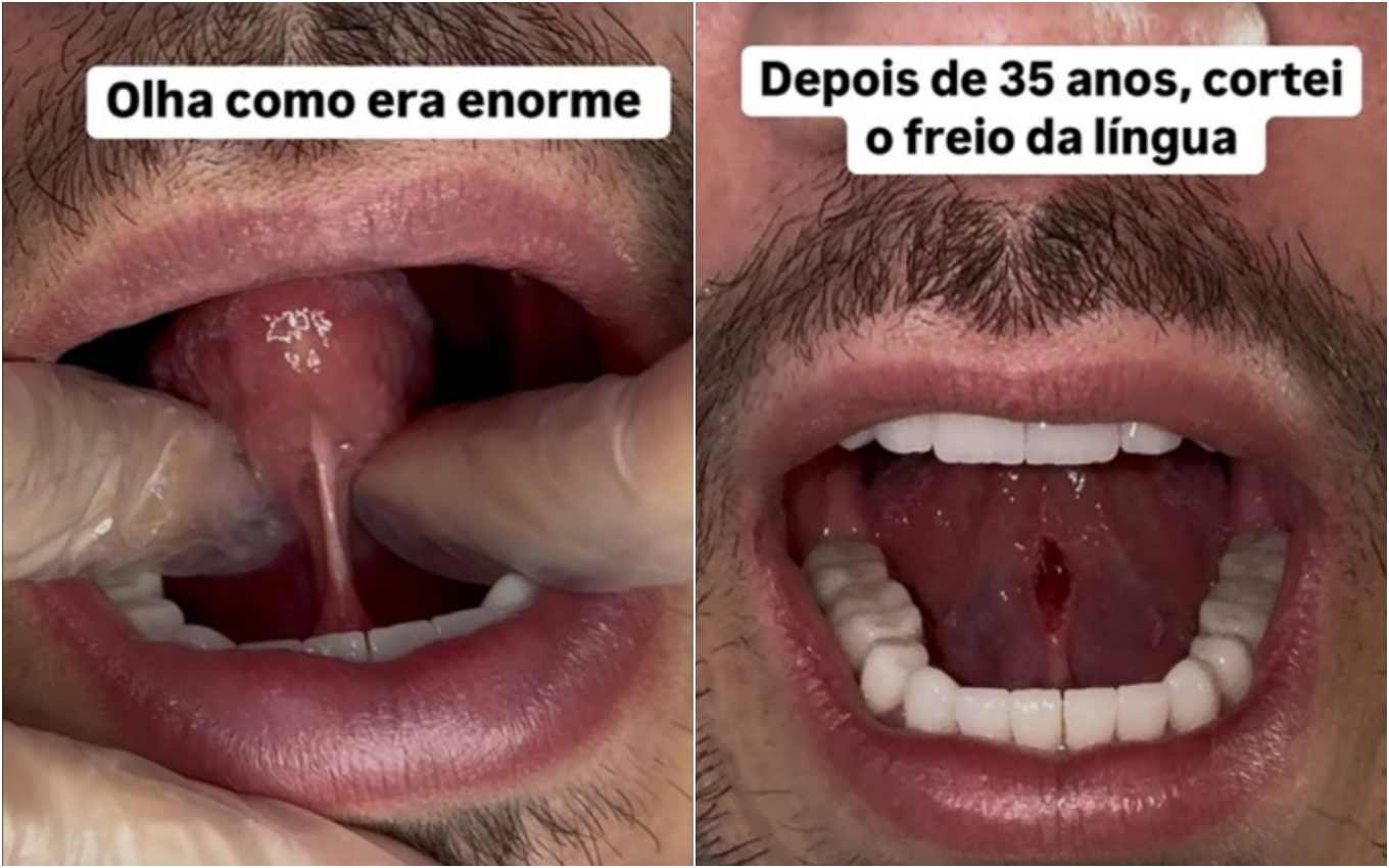 Post Eliezer Netto 